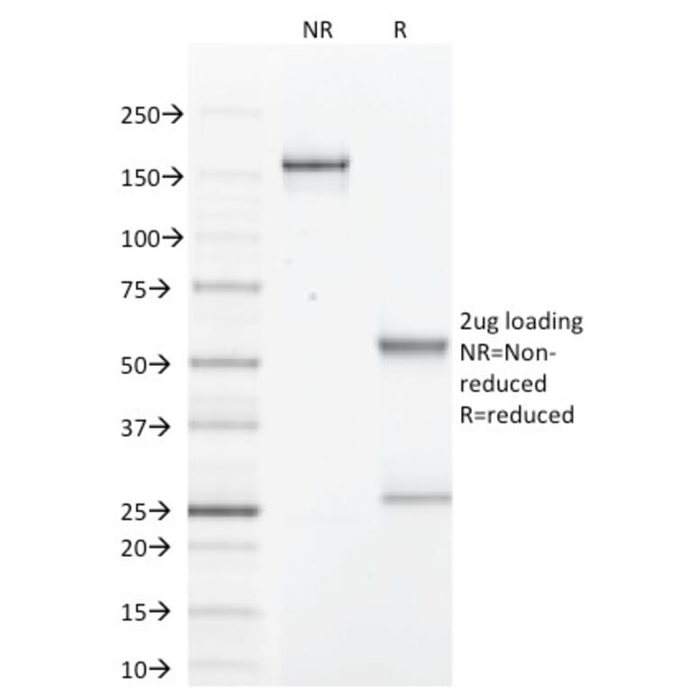 SDS-PAGE - Anti-GCDFP 15 Antibody [PIP/1571] - BSA and Azide free (A252816) - Antibodies.com
