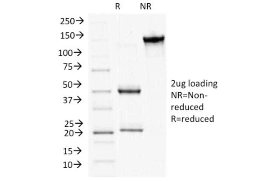 SDS-PAGE - Anti-Plakophilin 1 Antibody [10B2] - BSA and Azide free (A252816) - Antibodies.com