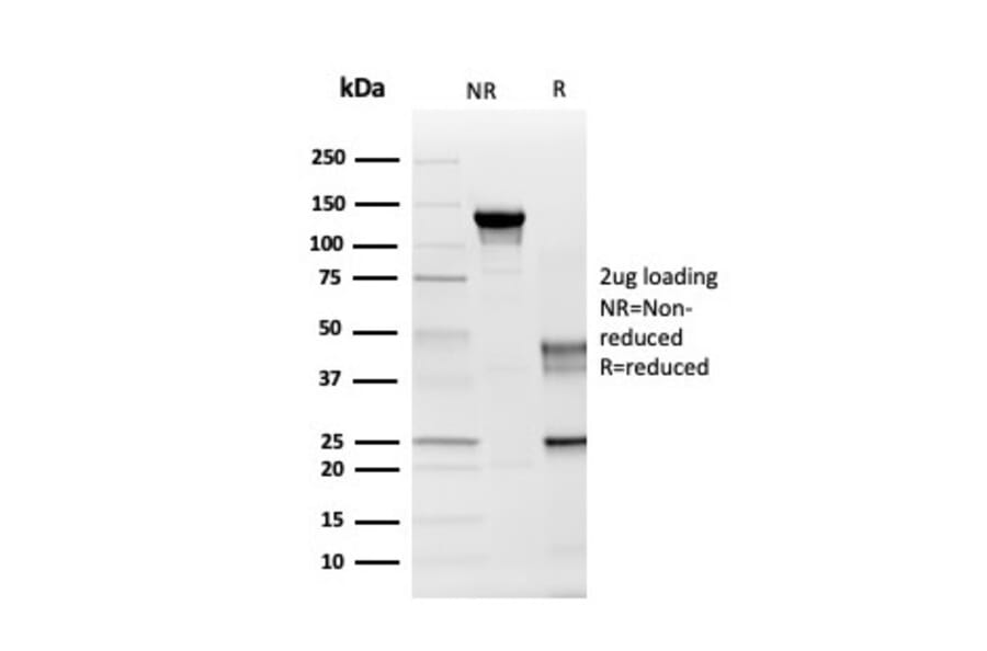 SDS-PAGE - Anti-Myelin PLP Antibody [PLP1/4259] - BSA and Azide free (A252818) - Antibodies.com