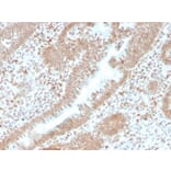 Immunohistochemistry - Anti-PMS2 Antibody [PMS2/4373R] - BSA and Azide free (A252820) - Antibodies.com