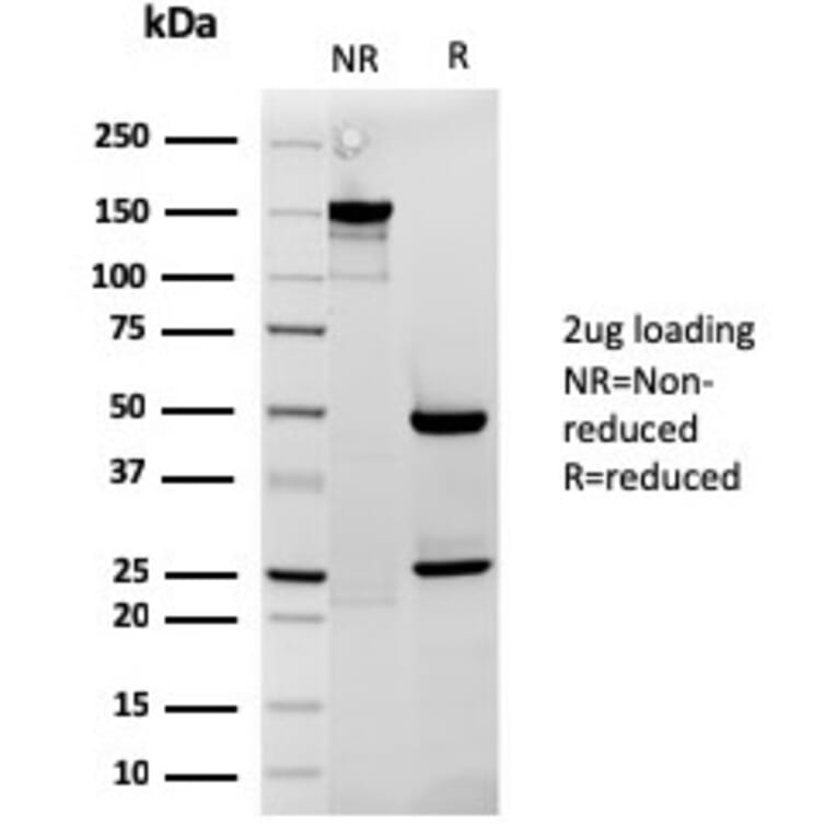 SDS-PAGE - Anti-Cytochrome C Antibody [rCYCS/1010] - BSA and Azide free (A252828) - Antibodies.com