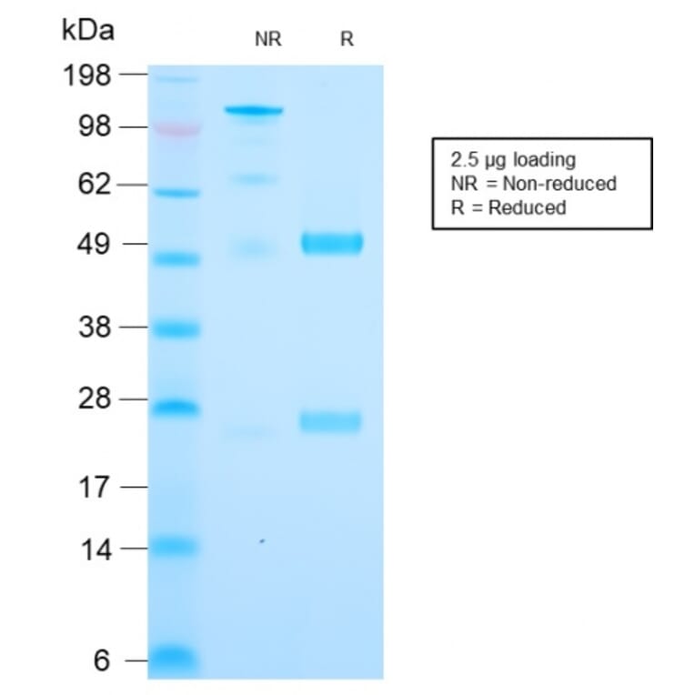 SDS-PAGE - Anti-Cytochrome C Antibody [CYCS/3128R] - BSA and Azide free (A252829) - Antibodies.com