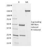 SDS-PAGE - Anti-Podocalyxin Antibody [3D3] - BSA and Azide free (A252830) - Antibodies.com