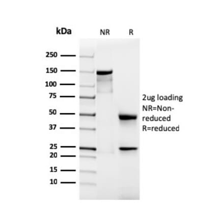 SDS-PAGE - Anti-Podocalyxin Antibody [rPODXL/2184] - BSA and Azide free (A252832) - Antibodies.com