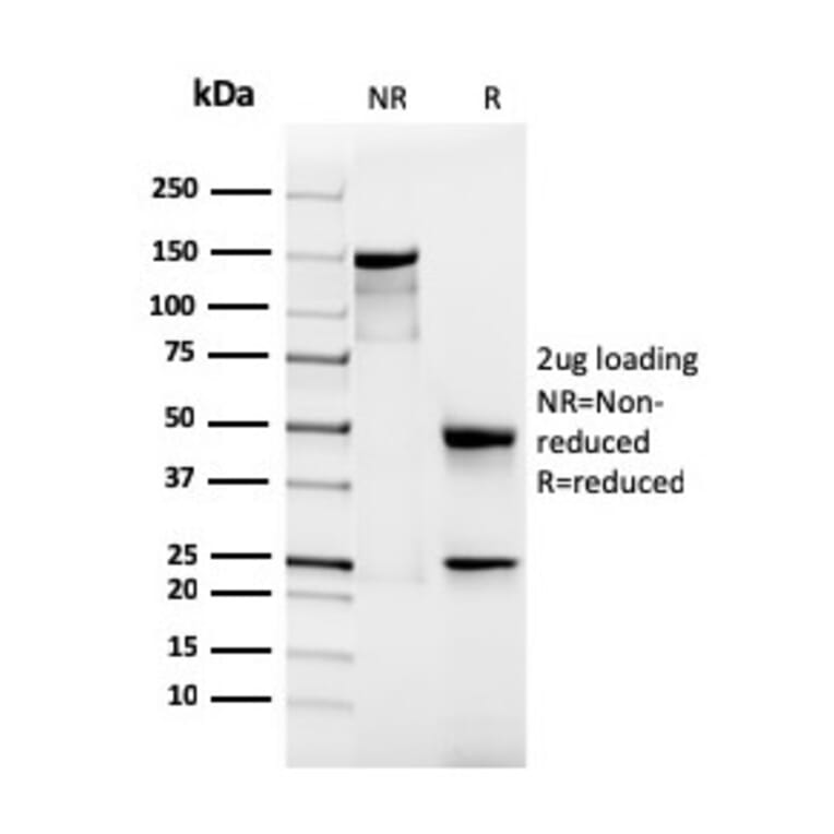 SDS-PAGE - Anti-Podocalyxin Antibody [rPODXL/2184] - BSA and Azide free (A252832) - Antibodies.com