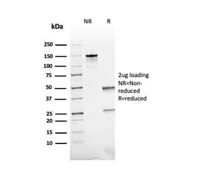 SDS-PAGE - Anti-ACTH Antibody [rCLIP/1407] - BSA and Azide free (A252835) - Antibodies.com