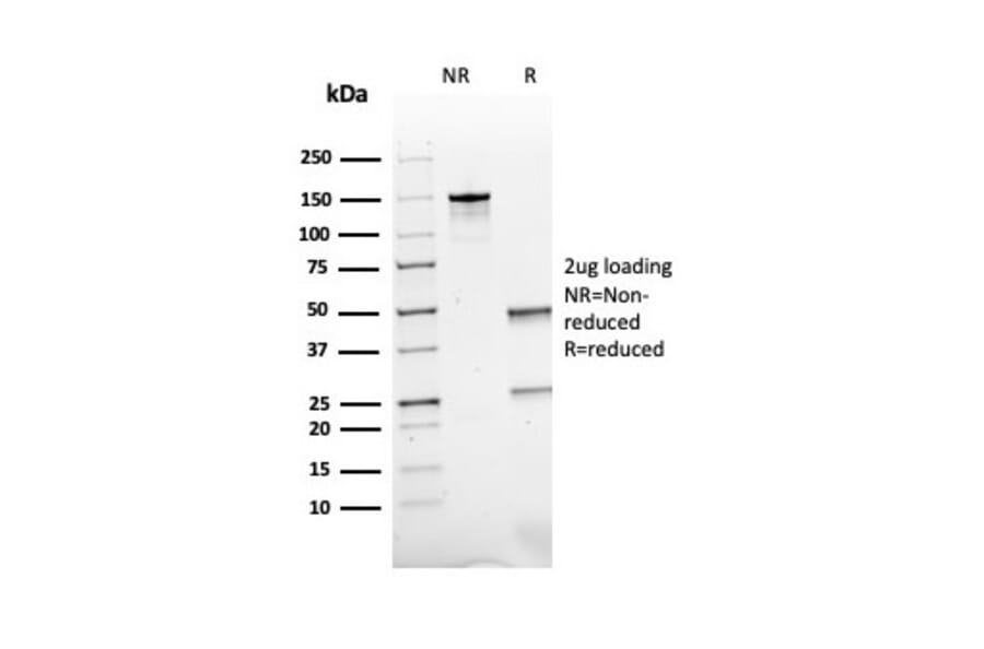 SDS-PAGE - Anti-ACTH Antibody [rCLIP/1407] - BSA and Azide free (A252835) - Antibodies.com
