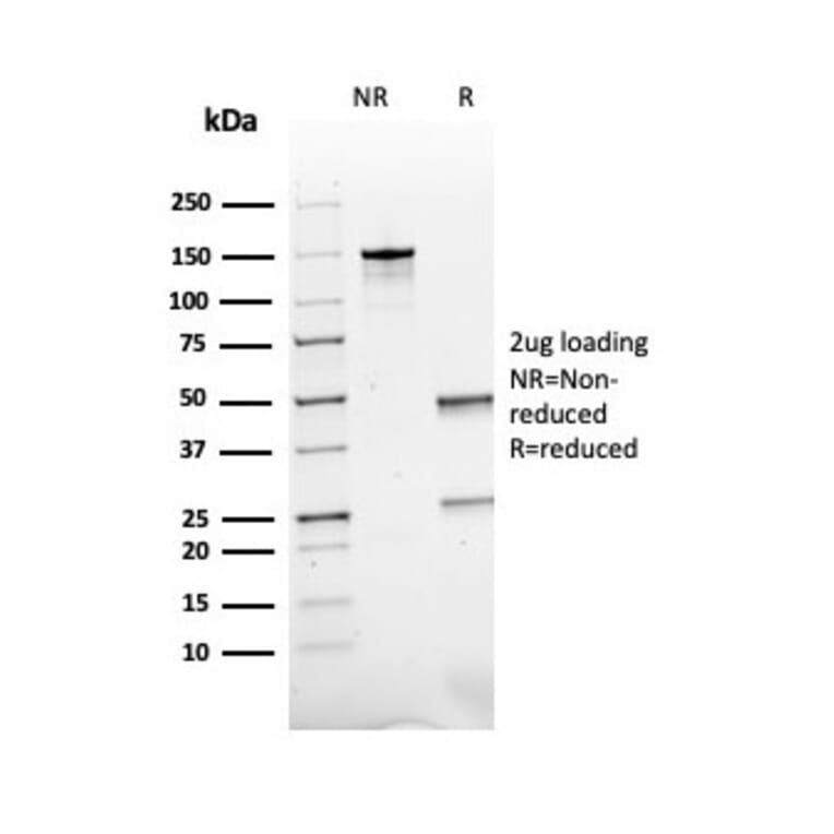 SDS-PAGE - Anti-ACTH Antibody [rCLIP/1407] - BSA and Azide free (A252835) - Antibodies.com