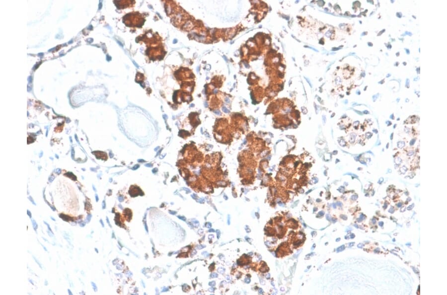 Immunohistochemistry - Anti-ACTH Antibody [rCLIP/1407] - BSA and Azide free (A252835) - Antibodies.com