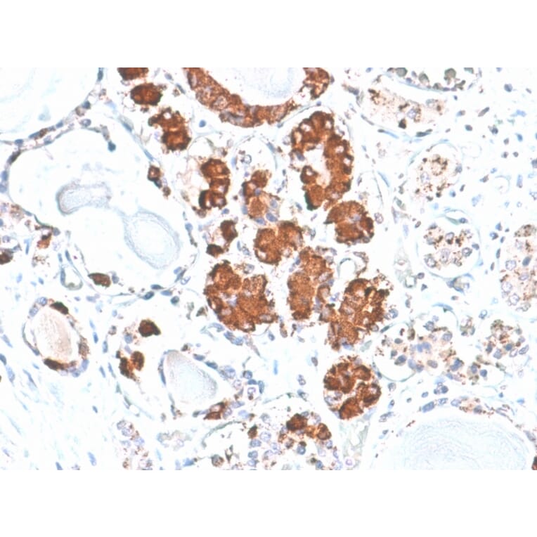 Immunohistochemistry - Anti-ACTH Antibody [rCLIP/1407] - BSA and Azide free (A252835) - Antibodies.com