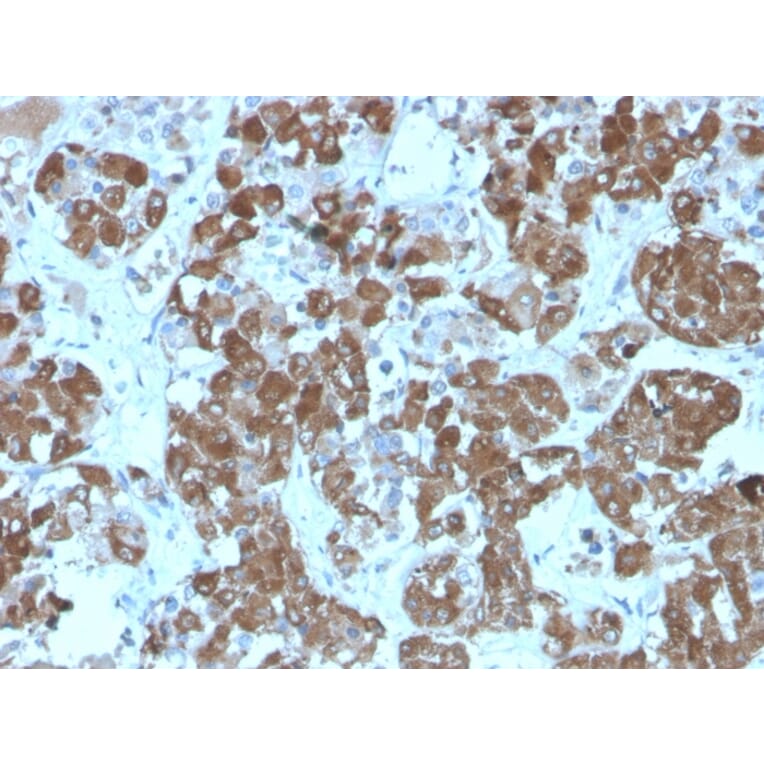Immunohistochemistry - Anti-ACTH Antibody [rCLIP/1407] - BSA and Azide free (A252834) - Antibodies.com