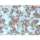 Immunohistochemistry - Anti-ACTH Antibody [rCLIP/1407] - BSA and Azide free (A252834) - Antibodies.com