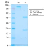 SDS-PAGE - Anti-ACTH Antibody [rCLIP/1418] - BSA and Azide free (A252835) - Antibodies.com