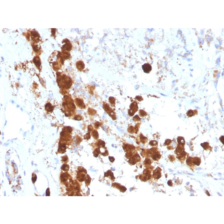 Immunohistochemistry - Anti-ACTH Antibody [SPM333] - BSA and Azide free (A252837) - Antibodies.com