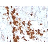 Immunohistochemistry - Anti-ACTH Antibody [SPM333] - BSA and Azide free (A252837) - Antibodies.com