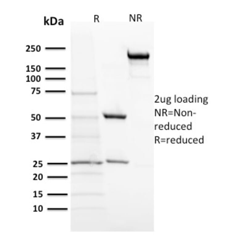 SDS-PAGE - Anti-ACTH Antibody [57] - BSA and Azide free (A252839) - Antibodies.com