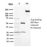SDS-PAGE - Anti-ACTH Antibody [57] - BSA and Azide free (A252839) - Antibodies.com