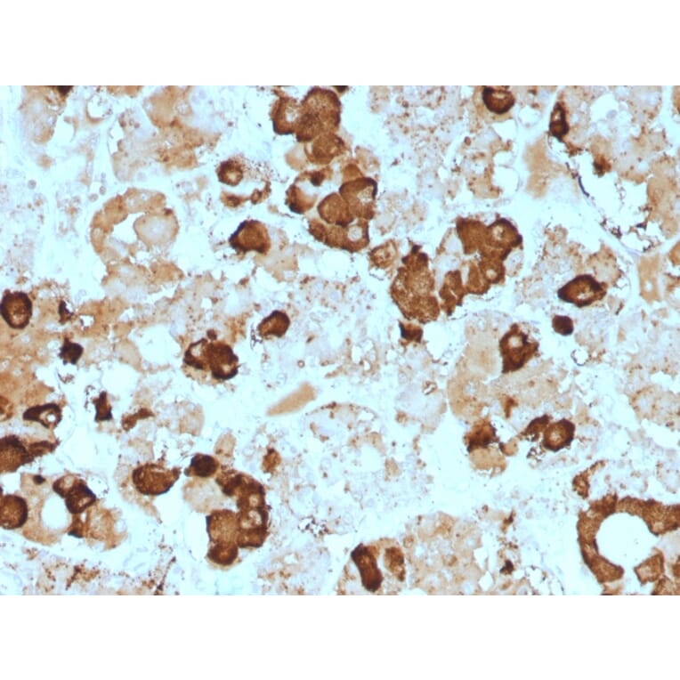 Immunohistochemistry - Anti-ACTH Antibody [57] - BSA and Azide free (A252838) - Antibodies.com