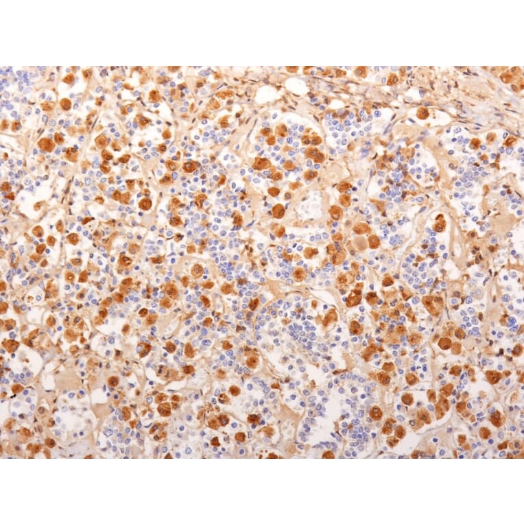 Immunohistochemistry - Anti-ACTH Antibody [2F6] - BSA and Azide free (A252839) - Antibodies.com