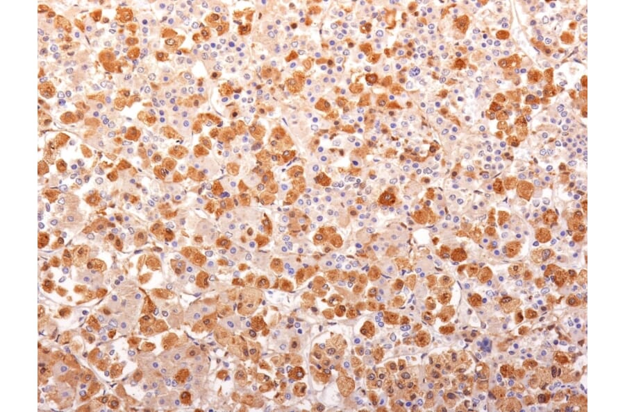 Immunohistochemistry - Anti-ACTH Antibody [AH26 + 57] - BSA and Azide free (A249661) - Antibodies.com