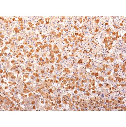 Immunohistochemistry - Anti-ACTH Antibody [r57] - BSA and Azide free (A252841) - Antibodies.com