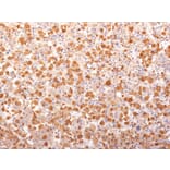 Immunohistochemistry - Anti-ACTH Antibody [r57] - BSA and Azide free (A252841) - Antibodies.com