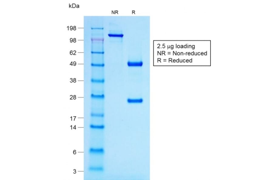 SDS-PAGE - Anti-ACTH Antibody [r57] - BSA and Azide free (A252842) - Antibodies.com