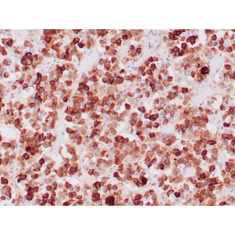 Immunohistochemistry - Anti-ACTH Antibody [CLIP/1407] - BSA and Azide free (A252842) - Antibodies.com