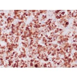 Immunohistochemistry - Anti-ACTH Antibody [CLIP/1407] - BSA and Azide free (A252842) - Antibodies.com