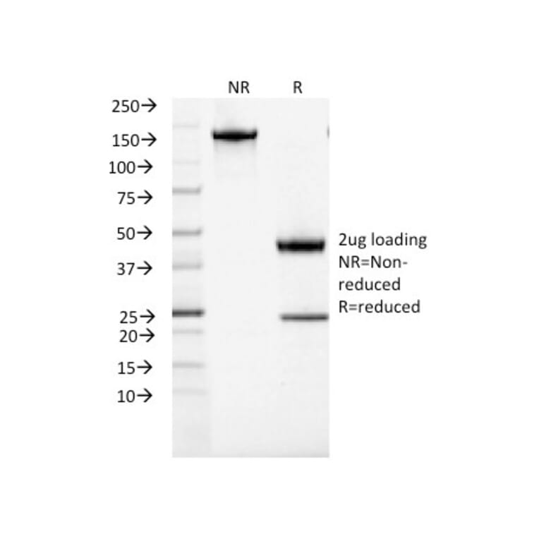 SDS-PAGE - Anti-ACTH Antibody [CLIP/1407] - BSA and Azide free (A252843) - Antibodies.com