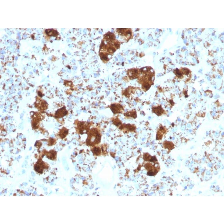 Immunohistochemistry - Anti-ACTH Antibody [SPM501] - BSA and Azide free (A252843) - Antibodies.com