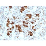 Immunohistochemistry - Anti-ACTH Antibody [SPM501] - BSA and Azide free (A252843) - Antibodies.com