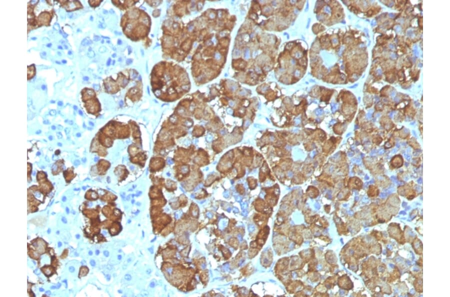 Immunohistochemistry - Anti-ACTH Antibody [CLIP/1449] - BSA and Azide free (A252845) - Antibodies.com