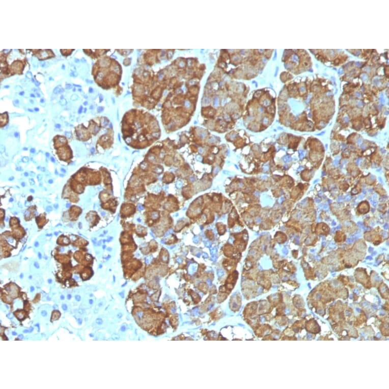 Immunohistochemistry - Anti-ACTH Antibody [CLIP/1449] - BSA and Azide free (A252845) - Antibodies.com