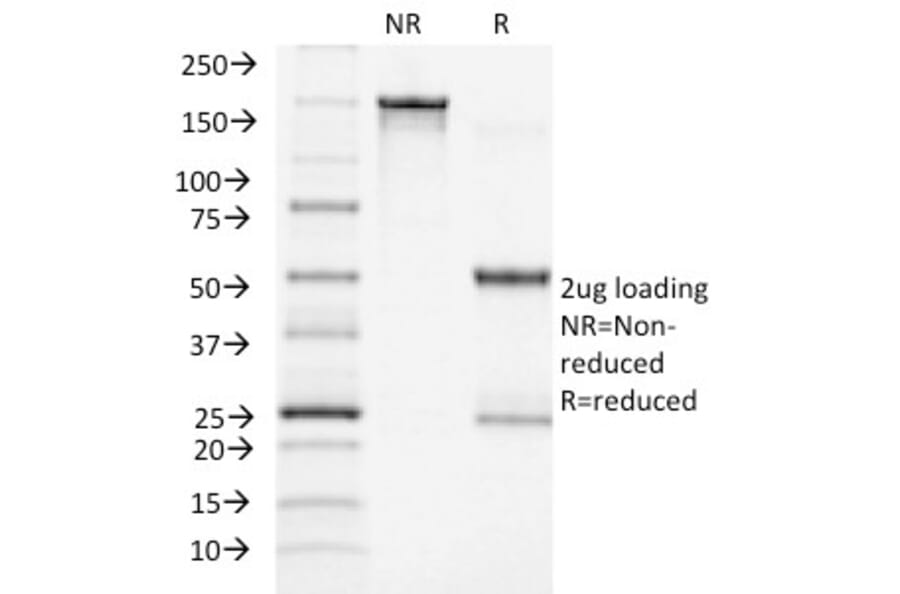 SDS-PAGE - Anti-ACTH Antibody [CLIP/1449] - BSA and Azide free (A252846) - Antibodies.com