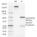 SDS-PAGE - Anti-ACTH Antibody [CLIP/1449] - BSA and Azide free (A252846) - Antibodies.com