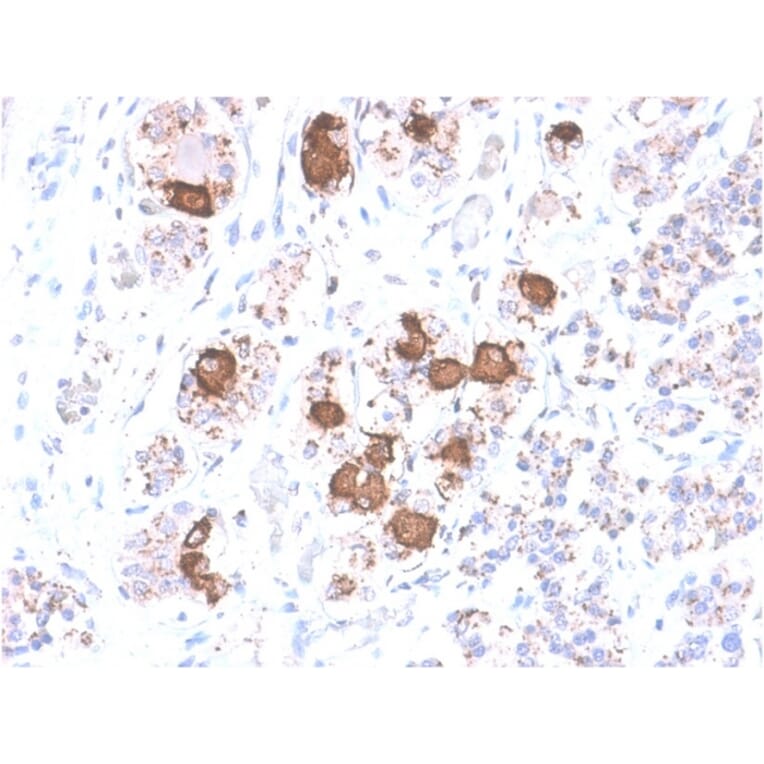 Immunohistochemistry - Anti-ACTH Antibody [CLIP/2040R] - BSA and Azide free (A252846) - Antibodies.com