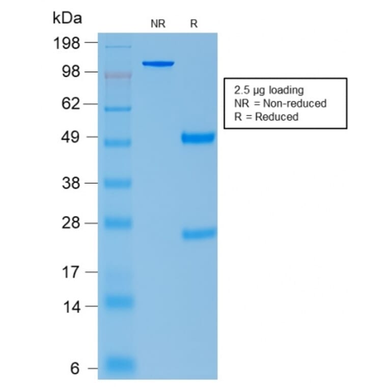 SDS-PAGE - Anti-ACTH Antibody [CLIP/2040R] - BSA and Azide free (A252847) - Antibodies.com