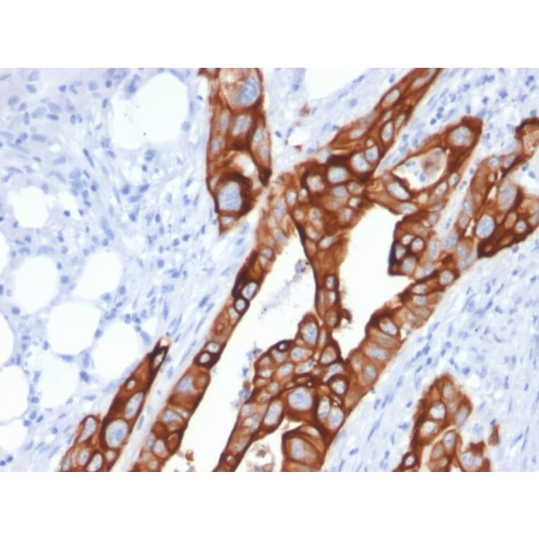 Immunohistochemistry - Anti-Cytokeratin 20 Antibody [KRT20/1991] - BSA and Azide free (A252849) - Antibodies.com