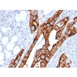 Immunohistochemistry - Anti-Cytokeratin 20 Antibody [KRT20/1991] - BSA and Azide free (A252849) - Antibodies.com