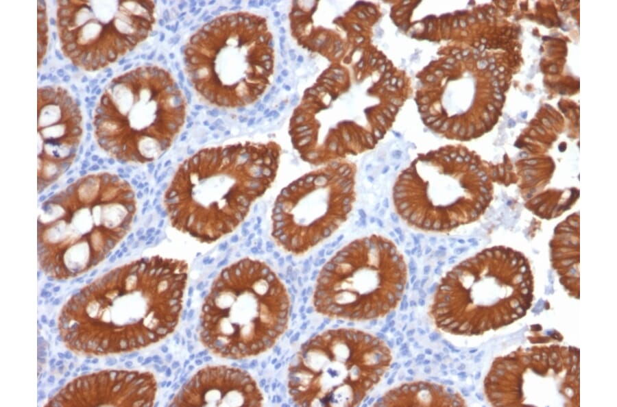 Immunohistochemistry - Anti-Cytokeratin 20 Antibody [KRT20/1991] - BSA and Azide free (A252849) - Antibodies.com