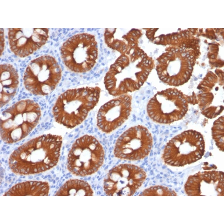 Immunohistochemistry - Anti-Cytokeratin 20 Antibody [KRT20/1991] - BSA and Azide free (A252849) - Antibodies.com