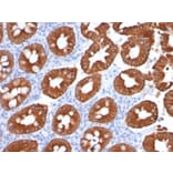 Immunohistochemistry - Anti-Cytokeratin 20 Antibody [KRT20/1991] - BSA and Azide free (A252849) - Antibodies.com