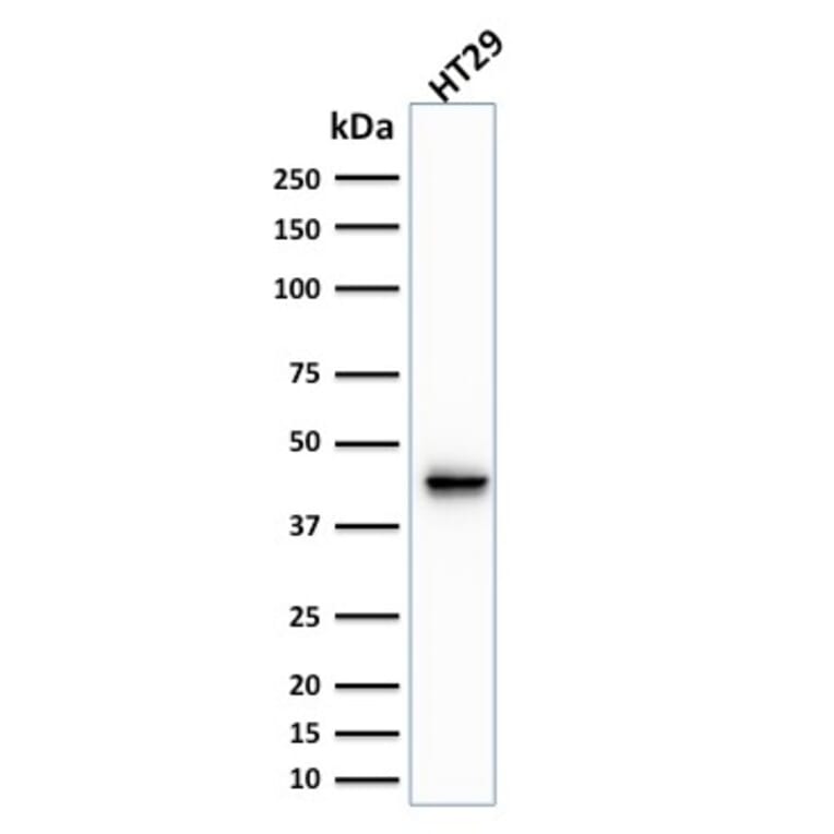 Western Blot - Anti-Cytokeratin 20 Antibody [KRT20/1991] - BSA and Azide free (A252849) - Antibodies.com