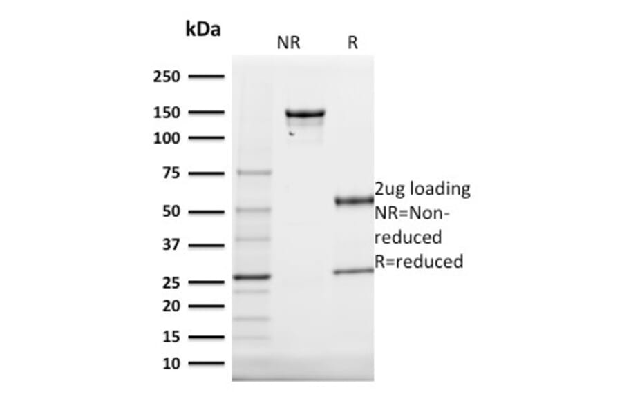 SDS-PAGE - Anti-Cytokeratin 20 Antibody [KRT20/1991] - BSA and Azide free (A252849) - Antibodies.com