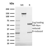 SDS-PAGE - Anti-Cytokeratin 20 Antibody [KRT20/1991] - BSA and Azide free (A252849) - Antibodies.com