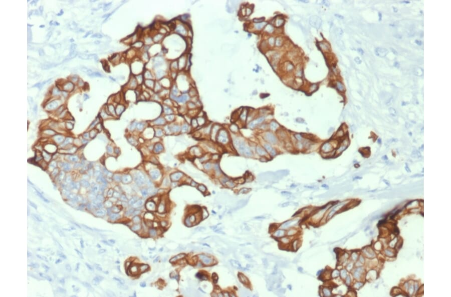 Immunohistochemistry - Anti-Cytokeratin 20 Antibody [KRT20/1992] - BSA and Azide free (A252850) - Antibodies.com