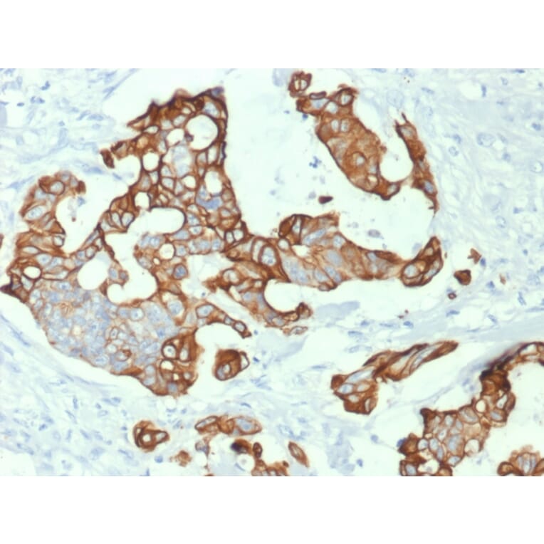 Immunohistochemistry - Anti-Cytokeratin 20 Antibody [KRT20/1992] - BSA and Azide free (A252850) - Antibodies.com