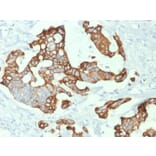 Immunohistochemistry - Anti-Cytokeratin 20 Antibody [KRT20/1992] - BSA and Azide free (A252850) - Antibodies.com