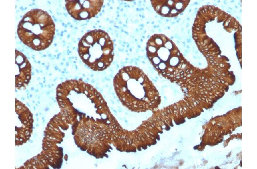 Immunohistochemistry - Anti-Cytokeratin 20 Antibody [KRT20/1992] - BSA and Azide free (A252850) - Antibodies.com
